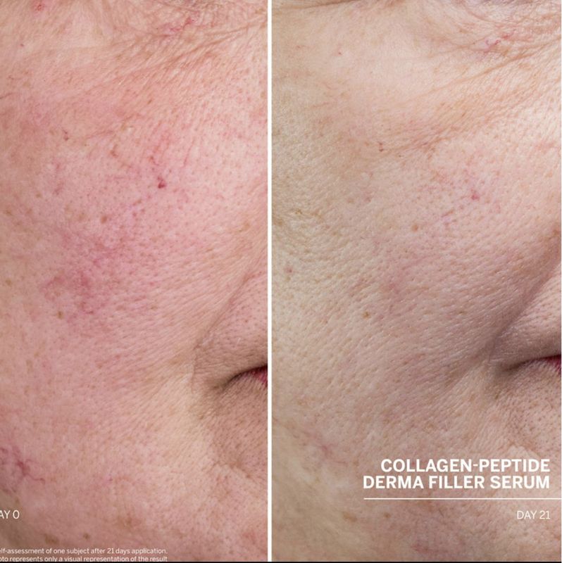 SMALL SIZE Doctor Babor Collagen-Peptide Derma Filler Serum 